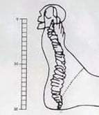 Tecnica metamorfica